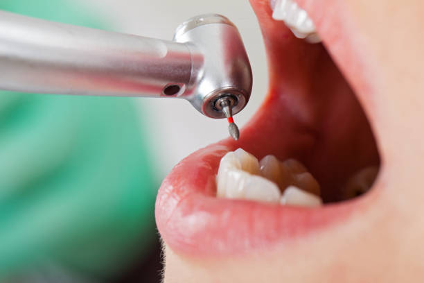 Best Emergency Treatment for Toothache in Fulton, MD